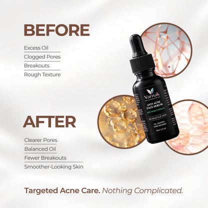 Varnak 2% Salicylic Acid Anti-Acne Face Serum